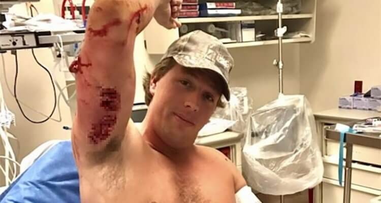 Dutch TV presenter gets bitten by Shark 1